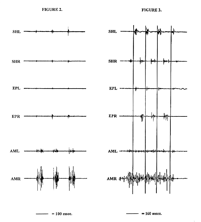 fish feeding electromyograph